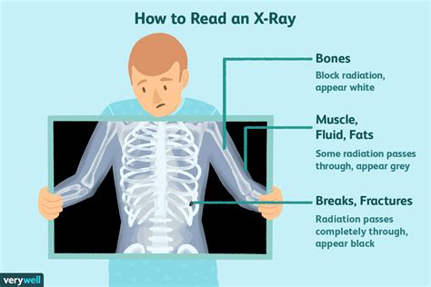 types of x ray tests